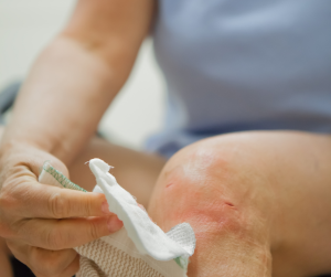 What is arthroscopy?